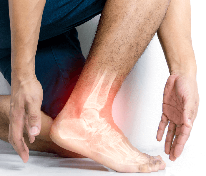 Νάρθηκας Ποδοκνημικής Με Gel & Αέρα (Orthopedic)